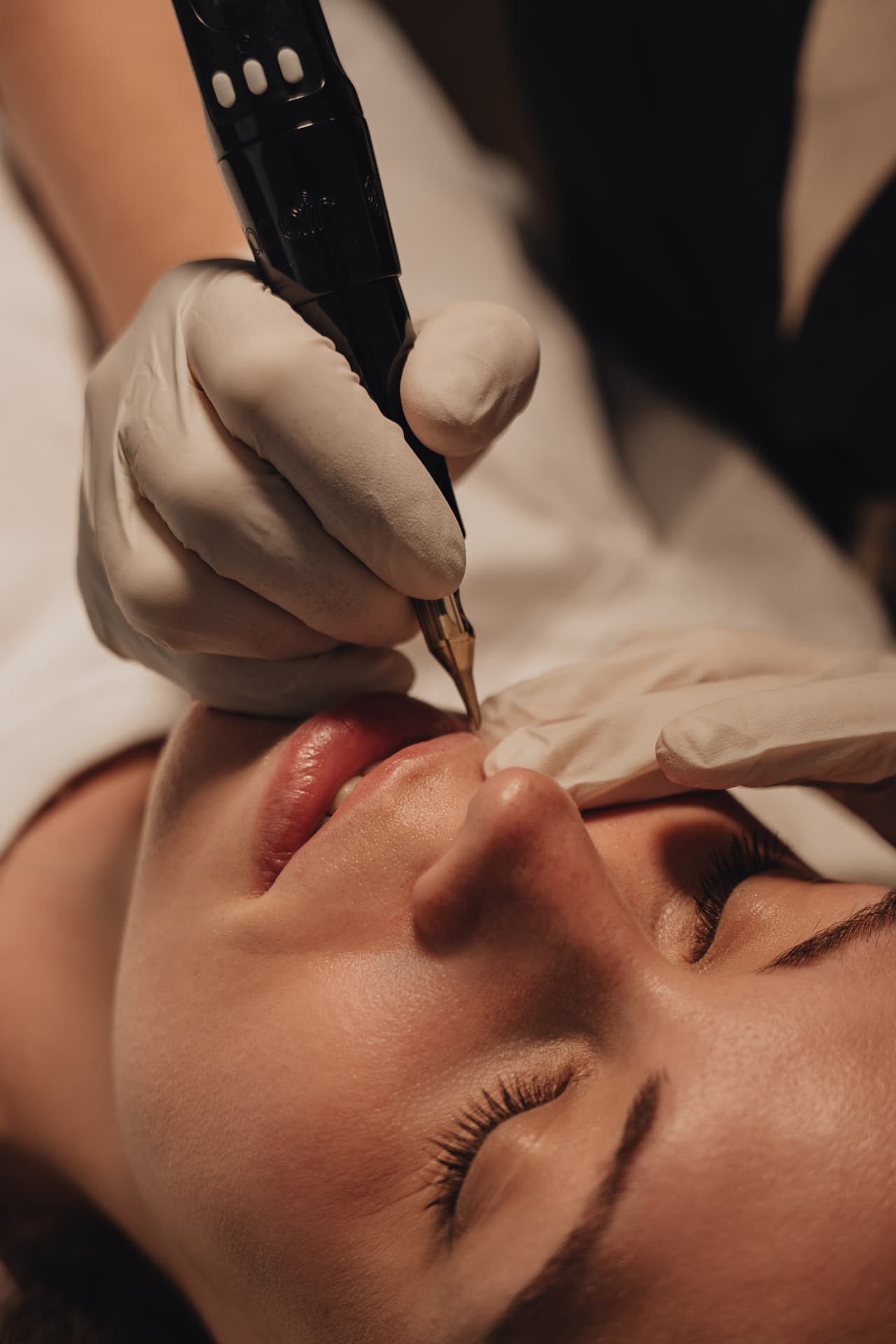 Lippenpigmentierung während der Behandlung